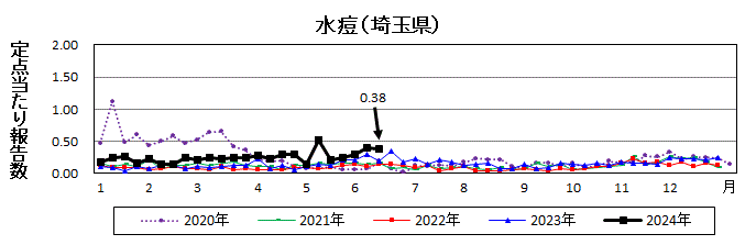 水痘流行グラフ